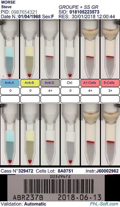 Exemple Vision Images 1