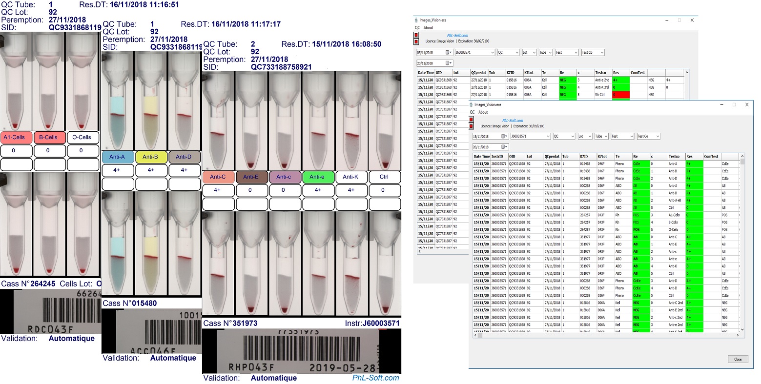 Exemple Vision Images 2